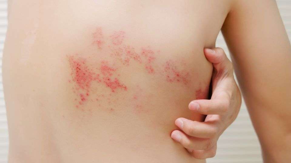 Shingles vaccine consultation and administration at pharmacy